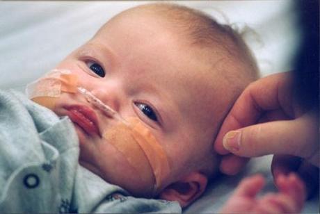 El virus respiratorio sincitial