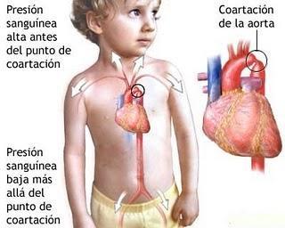 ¿Sepsis o cardiopatía?