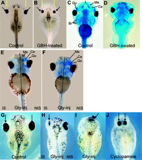 Glifosato y Toxicidad Fetal