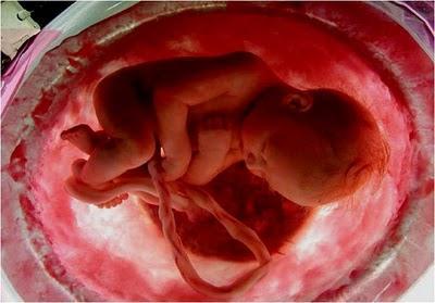 EN EL VIENTRE MATERNO EN EL VIENTRE MATERNO