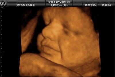 EN EL VIENTRE MATERNO EN EL VIENTRE MATERNO