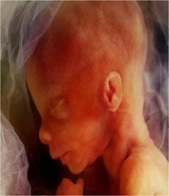 EN EL VIENTRE MATERNO EN EL VIENTRE MATERNO