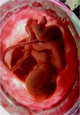 EN EL VIENTRE MATERNO EN EL VIENTRE MATERNO