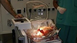 El Hospital Puerta de Hierro estrena un sistema pionero de transporte de órganos para trasplante
