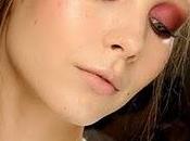 Tratamientos para novias