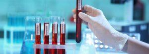 Diagnóstico de la enfermedad de Lyme: qué pruebas de laboratorio puede esperar