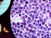 genoma leucemia esconde