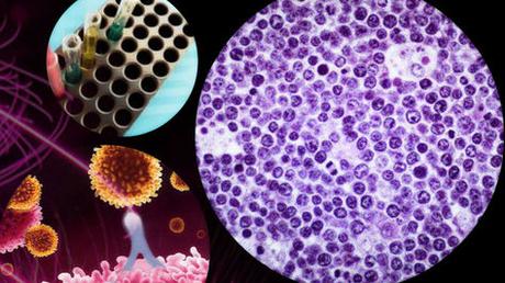 Lo que el genoma de la leucemia esconde