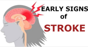 ¡5 señales para saber que se avecina un derrame cerebral! ¡Esto puede salvar tu vida! 5early