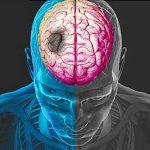 Intervenciones para mejorar el control de factores de riesgo modificables en la prevención secundaria del accidente cerebrovascular.