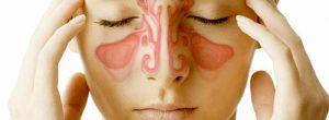 Sinusitis: una sensación ardiente en los senos