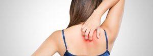 Notalgia parestésica: ¿picazón en la parte superior de la espalda sin una causa obvia?
