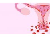 Causas senos subdesarrollados mujeres