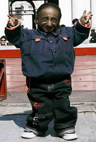 Personas Que Convirtieron Sus “Defectos” En Virtudes