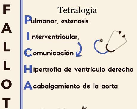 Tetralogía de fallot memotecnia