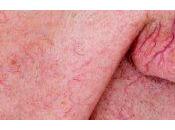 Posibles causas templos inflamados