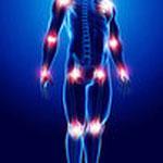 Reuma.pro informa sobre las nuevos tratamientos de la artritis psoriásica activa