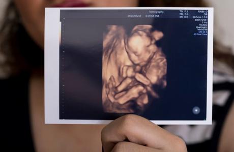 Ecografías 4d y 5d en Zaragoza: ¡una experiencia emocionante durante el embarazo en ecox4d! Ecografías 4d y 5d en Zaragoza: ¡una experiencia emocionante durante el embarazo en ecox4d!