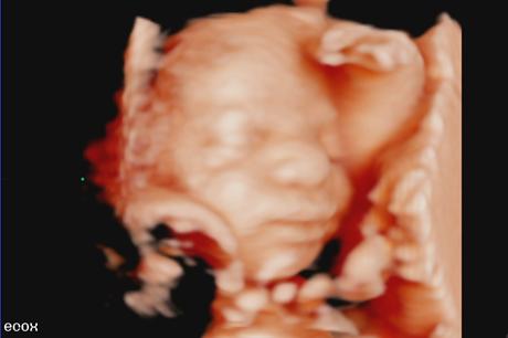 Ecografías 4d y 5d en Zaragoza: ¡una experiencia emocionante durante el embarazo en ecox4d! Ecografías 4d y 5d en Zaragoza: ¡una experiencia emocionante durante el embarazo en ecox4d!