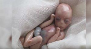 Bebé nacido muerto a los 5 meses, 8 minutos después los médicos se sorprenden por el milagro omg
