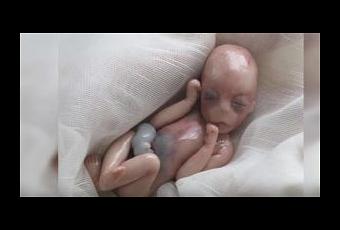 Bebe Nacido Muerto A Los 5 Meses 8 Minutos Despues Los Medicos Se Sorprenden Por El Milagro Paperblog