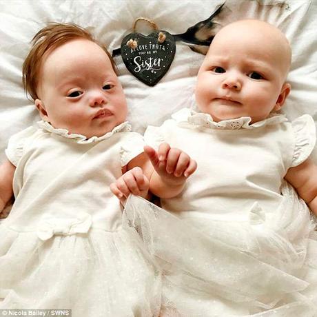 #Historias: Nacieron gemelas y una tiene Síndrome de #Down  / #Medicina #Salud #Ciencias