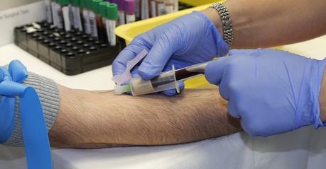 Tipos de sangre Transfusiones de sangre