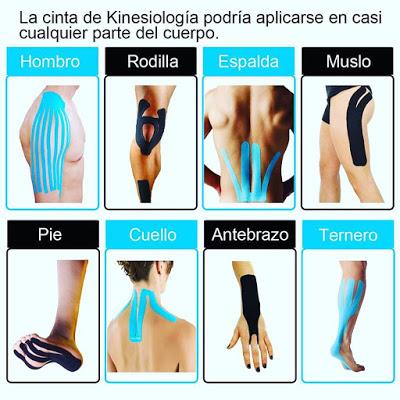 cinta kinesiologica, cinta de kinesiologia, kinesio, kinesiotape, cinta de colores, deporte, lesiones, dolor, 