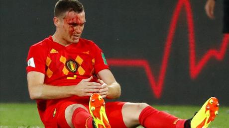 Vermaelen sangra tras una jugada en el partido ante Inglaterra. / REUTERS / FABRIZIO BENSCH