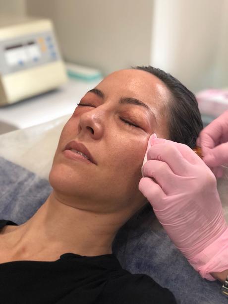 Fitness And Chicness-Carboxiterapia Dra. Gualda-4