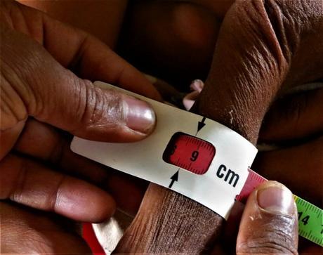 8,7 centímetros de esperanza