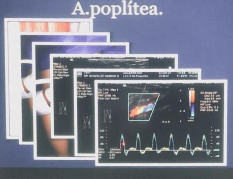 EVALUACION DEL DOPPLER ARTERIAL DE MIEMBROS INFERIORES