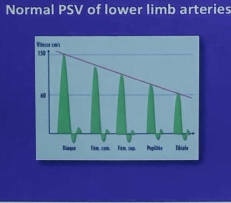 EVALUACION DEL DOPPLER ARTERIAL DE MIEMBROS INFERIORES