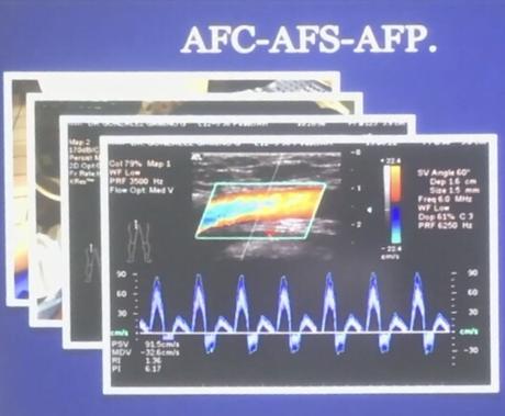 EVALUACION DEL DOPPLER ARTERIAL DE MIEMBROS INFERIORES