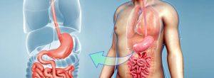 Frecuentes movimientos intestinales seguidos por estreñimiento: ¿es culpable el síndrome del intestino irritable?