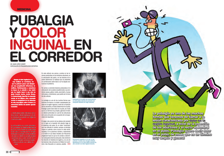 Pubalgia y dolor inguinal