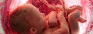 Embarazo críptico: cuando no sabe que está embarazada hasta que el bebé casi se debe