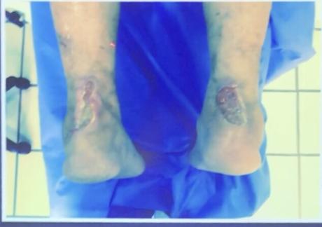 Caso clínico enarm # 4