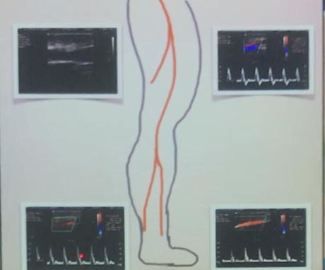 Caso clínico enarm # 4