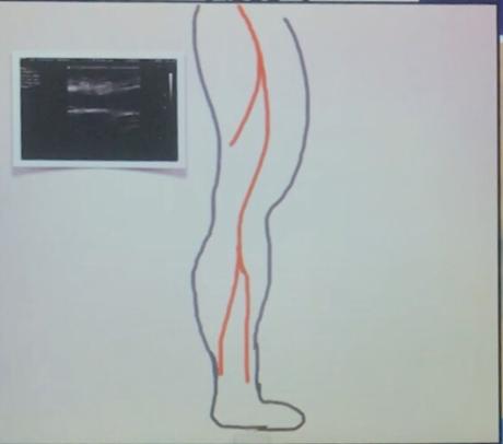 Caso clínico enarm # 4