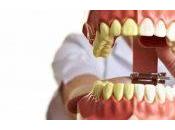 ¿Puede enfermedad encias (periodontal) arruinar implantes dentales existentes? ¿Hace nuevos sean imposibles?