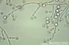 Test para detectar Candida Albicans