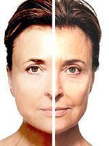 ¿Por qué envejecemos?