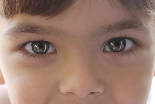 Los niños con gafas temen practicar deporte