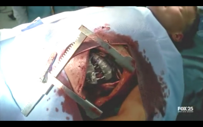 LO QUE FRINGE HA PERDIDO POR EL CAMINO