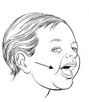 Estimulación perioral