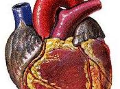 cirugía cardíaca adulto (anestesia cardiovascular