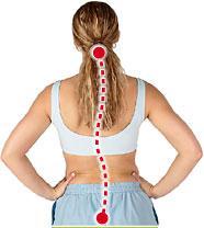 Acupuntura y tratamientos para la escoliosis