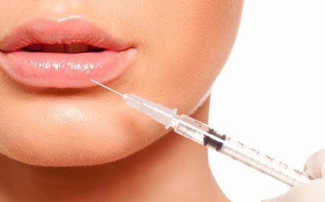 Aumento de labios con Ácido Hialurónico, qué debes saber