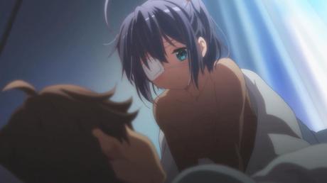 Top 15 chicas mas lindas con parche en el ojo Top 15 chicas mas lindas con parche en el ojo